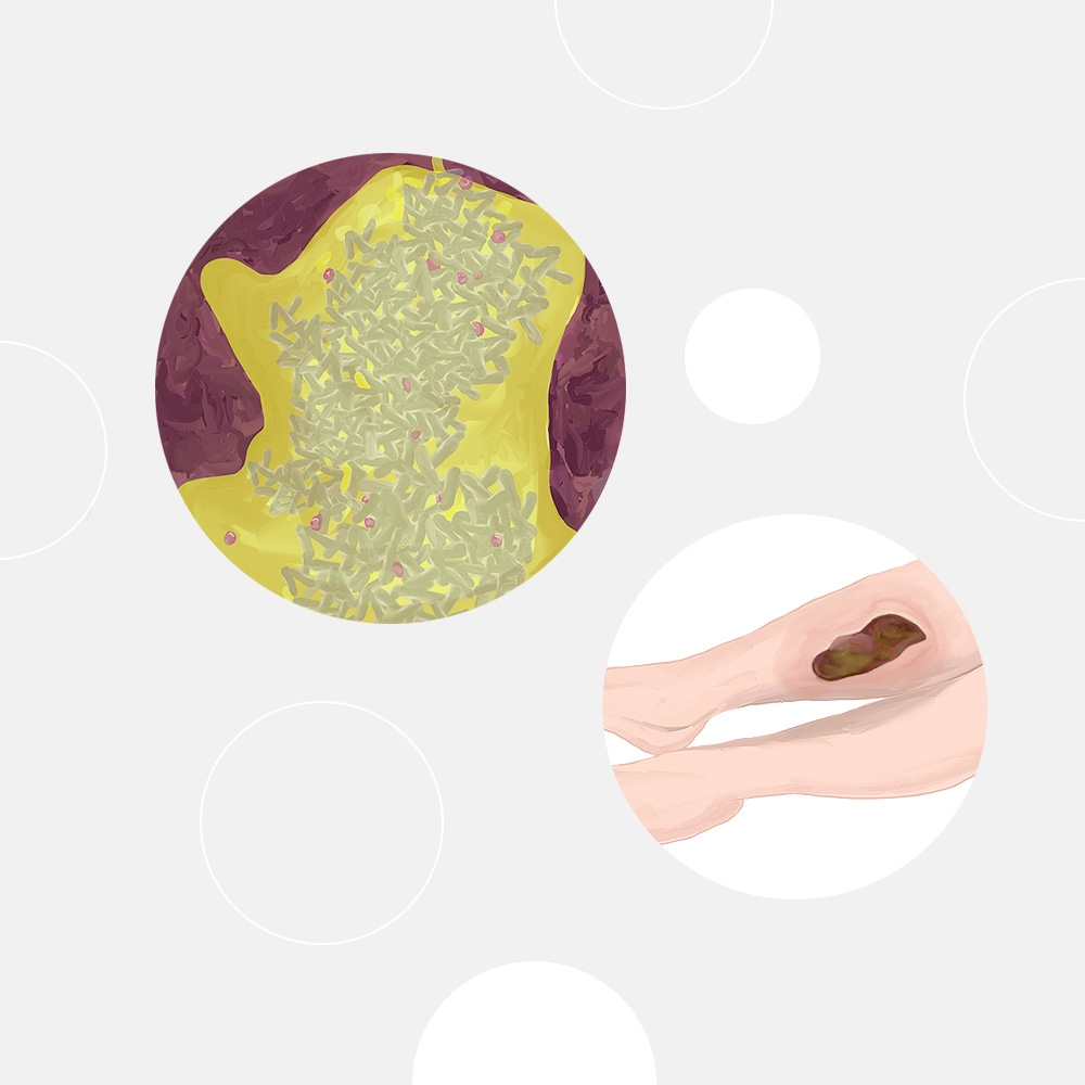 Untech - Untech - A multi-prized drug development startup | SPICE